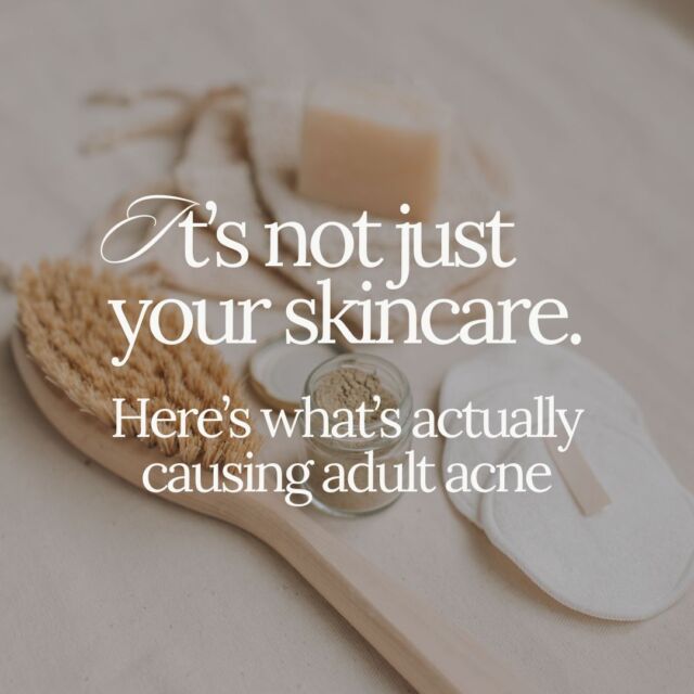 Still breaking out in your 20s or 30s—and wondering why?
You’ve tried the cleansers, the spot treatments, maybe even prescription creams…

But the truth is:
 ✨ Adult acne is an internal issue, not just a surface-level problem.

Here’s what most skincare advice doesn’t tell you: 
🔥 Blood sugar crashes → inflammation + oil spikes
 😵‍ Stress → more cortisol → more breakouts
 💊 Birth control → post-pill acne rebound
 🥬 Gut imbalances → poor detox = congested skin
 ⚠️ Low minerals → less skin healing from the inside out

You don’t need another 10-step routine—you need root-cause support.
 
Ready to dig together? Comment "acne" to see if this might be your next step!

#acnehelp #adultacne #rootcausehealing #holisticacne #skincarefromwithin #gutskinconnection #hormonalacne #holistichealth